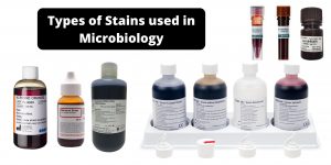 Types of Stains used in Microbiology
