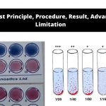 Widal Test Principle, Procedure, Result, Advantages, Limitation