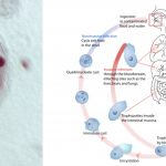 Entamoeba Histolytica Life Cycle, Transmission, Disease, Diagnosis, Treatment