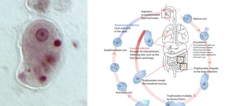Entamoeba Histolytica Life Cycle, Transmission, Disease, Diagnosis, Treatment