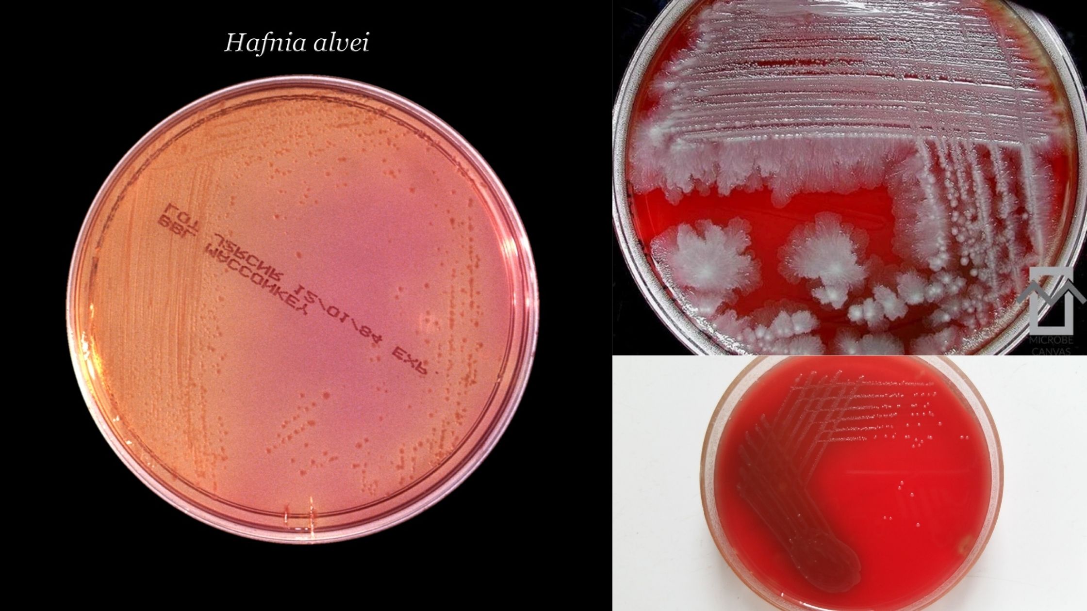 Biochemical Test of Hafnia alvei