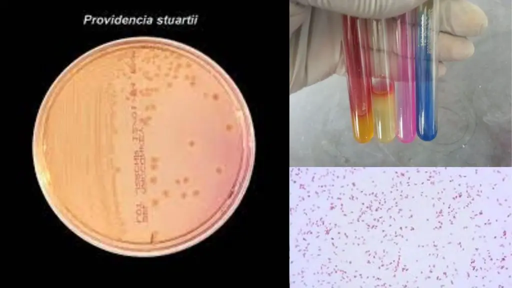 Biochemical Test of Providencia stuartii