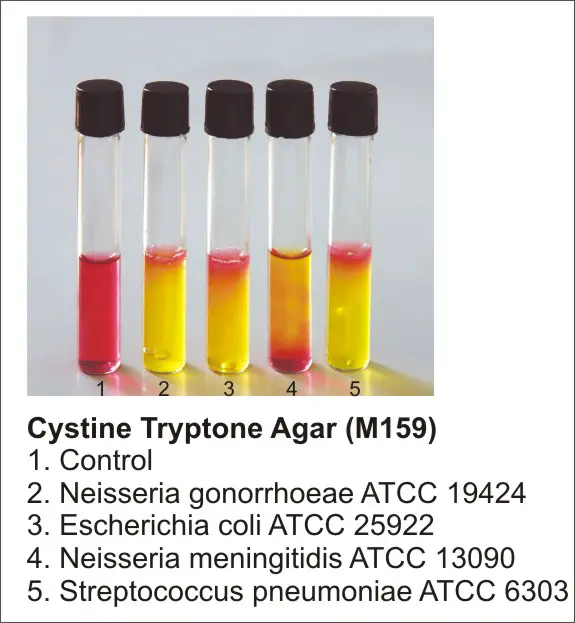 Result Interpretation of Cystine Tryptic Agar