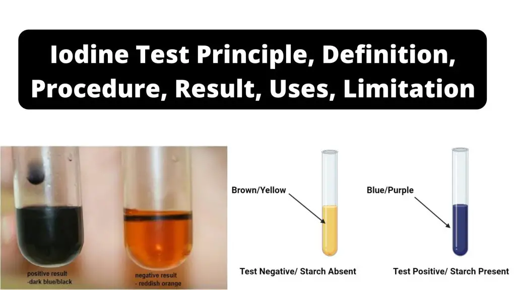 Iodine Test Principle, Definition, Procedure, Result, Uses, Limitation