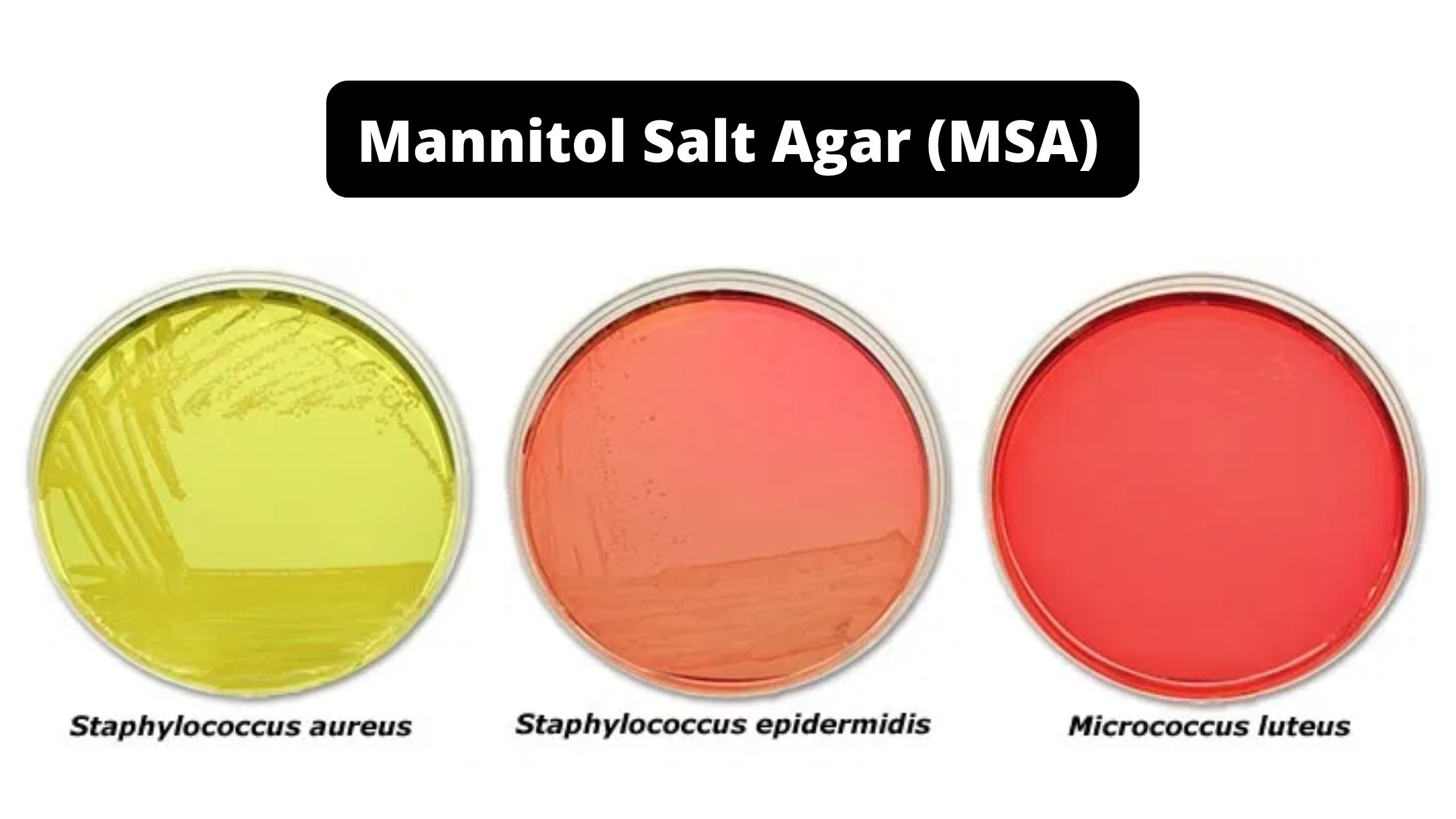 Mannitol Salt Agar (MSA)