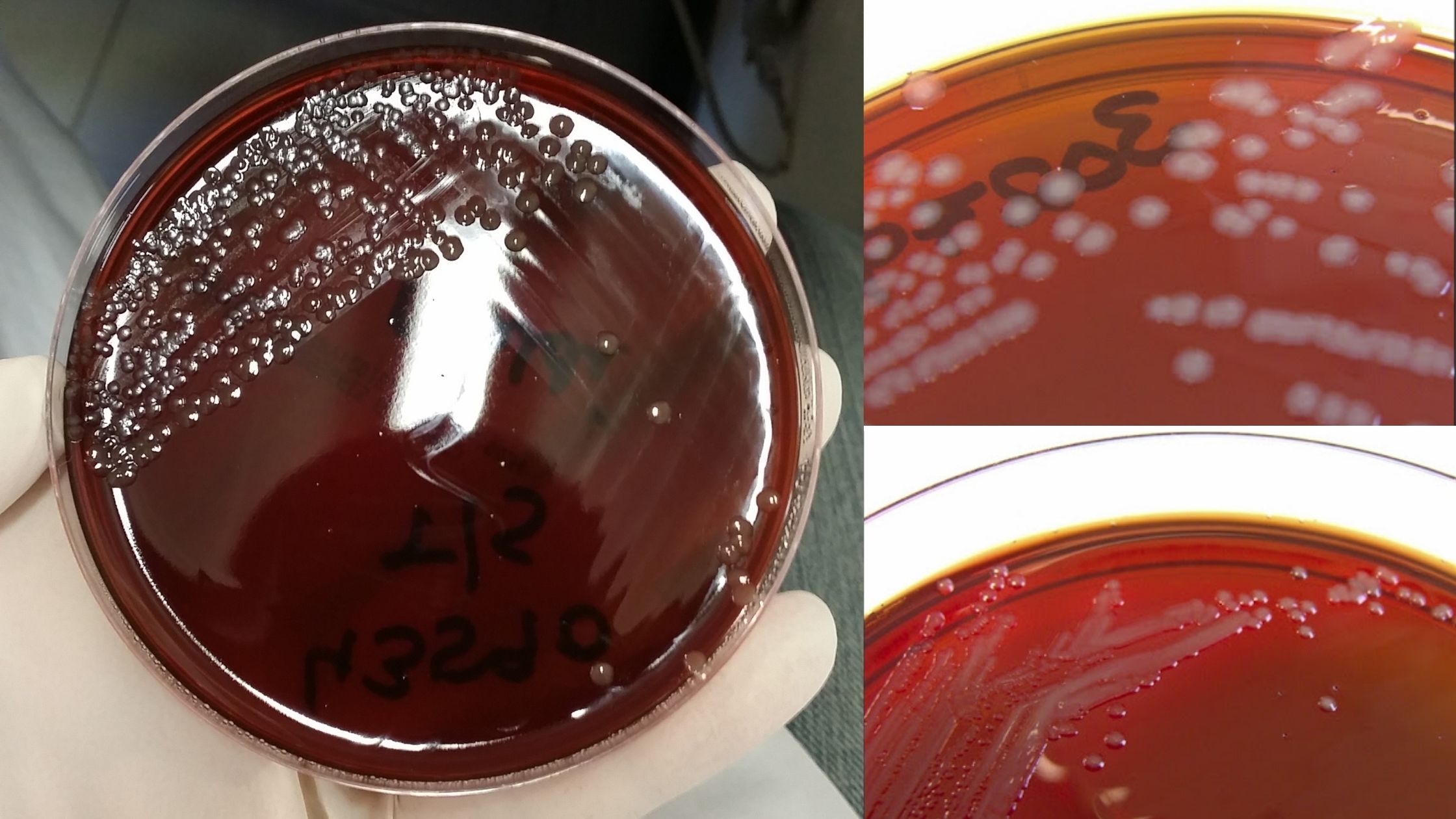 New York City Agar Composition, Preparation, Result, Uses