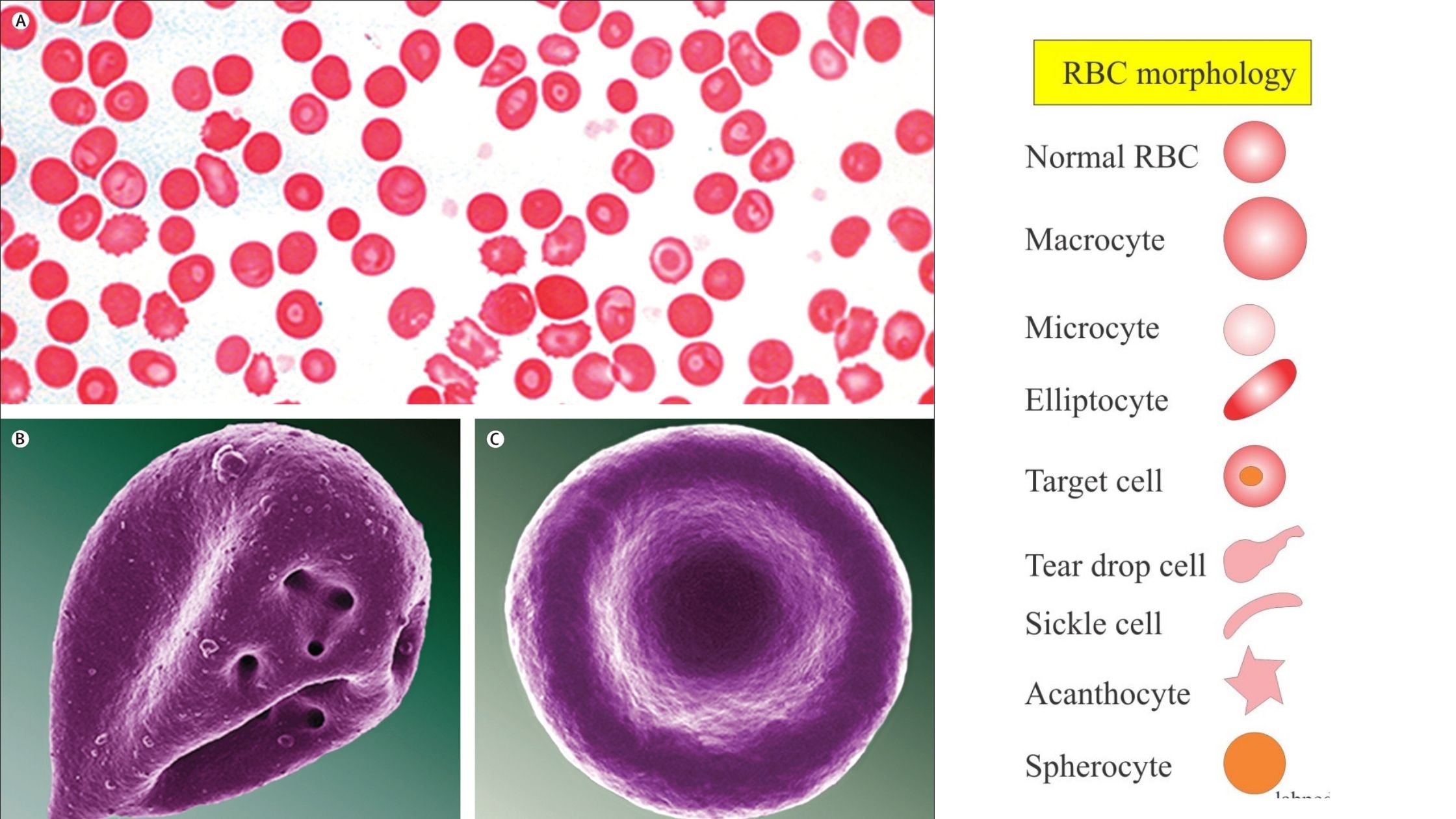 Red Blood Cell Morphology Size Shape Color And Inclusion Bodies