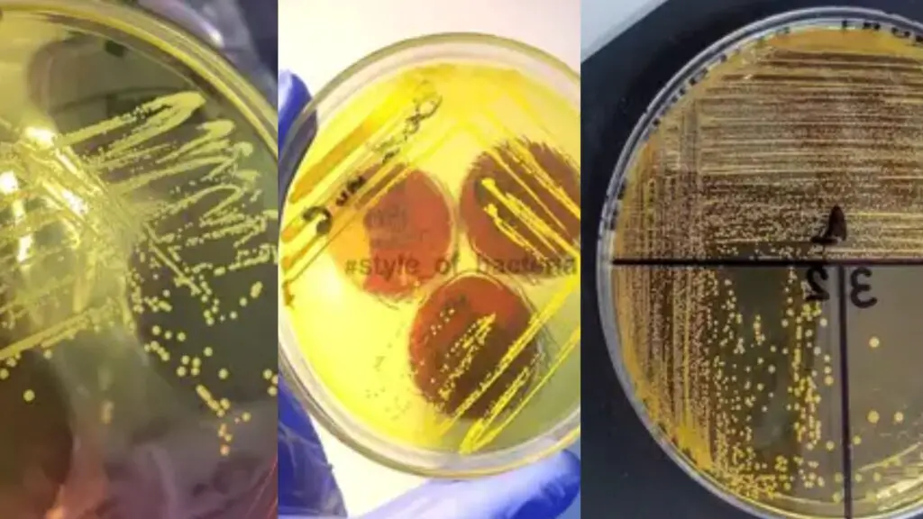 Results and Colony Characteristics in Mannitol Salt Agar (MSA)