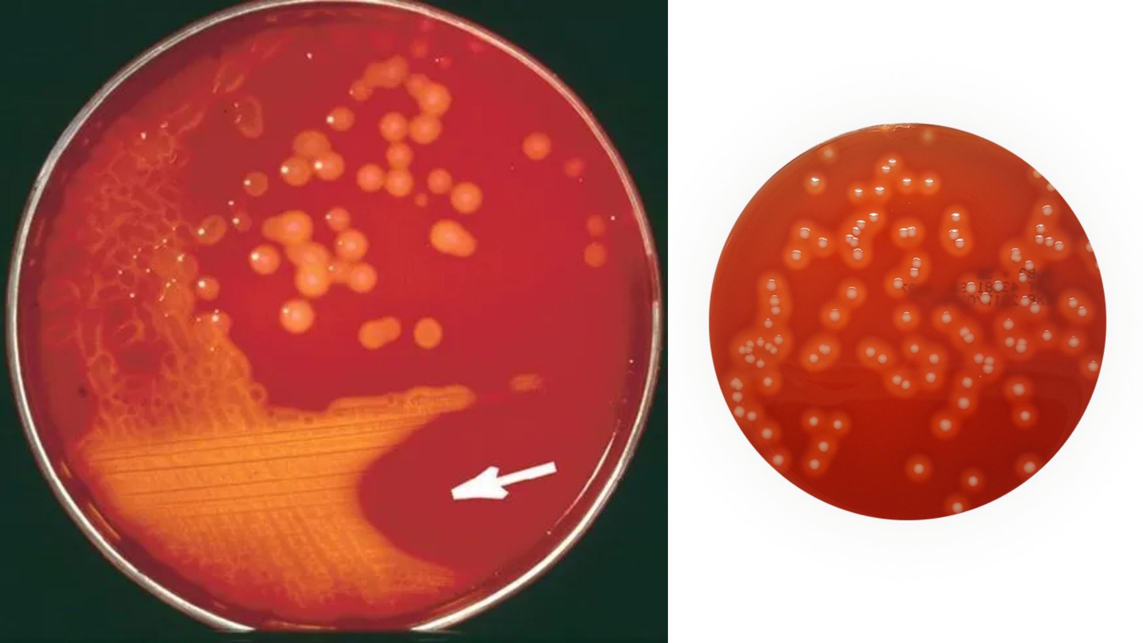 Streptococcus Selective Agar Composition, Preparation, and Principle