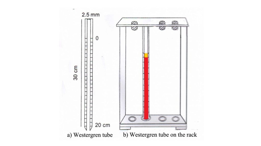 Westergren’s method of Erythrocyte Sedimentation Rate (ESR) 