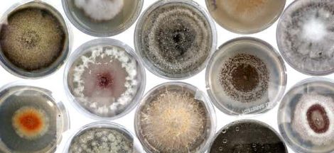 Common Fungal Culture Media and Their Uses