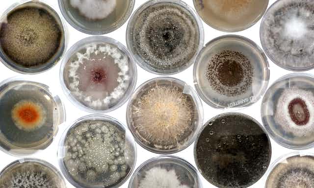 Common Fungal Culture Media and Their Uses