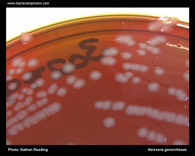 Neisseria gonorrhoeae on New York City Agar