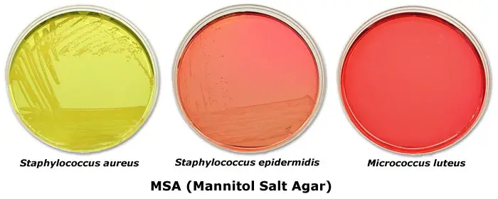 Results and Colony Characteristics in Mannitol Salt Agar (MSA)