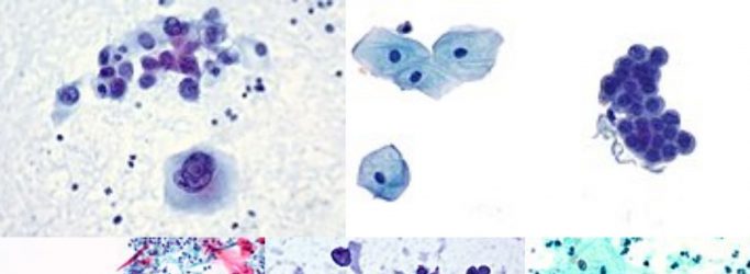Papanicolaou Staining (Pap stain)