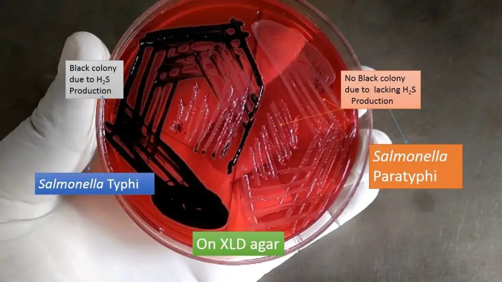 Results and Colony Characteristics of Xylose Lysine Deoxycholate (XLD) Agar