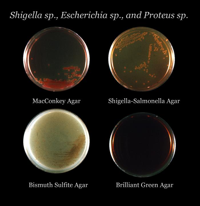 After 24 hours of growth, this image depicts four different agar media culture plates that had been inoculated with Shigella sp., Escherichia sp., and Proteus sp. bacteria, (clockwise: MacConkey, Shigella-Salmonella, Bismuth Sulfite, and Brilliant Green agars).