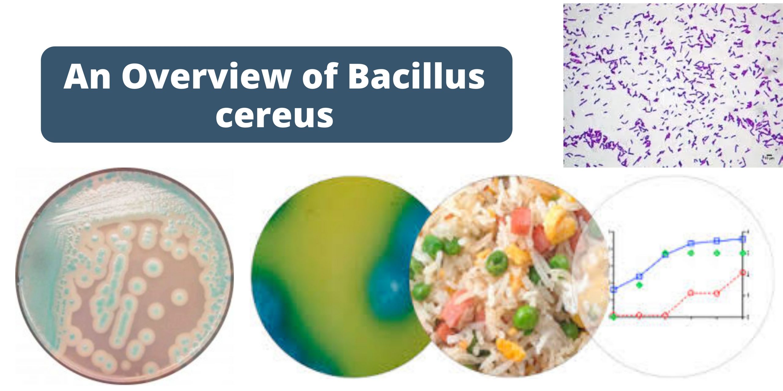 An Overview of Bacillus cereus