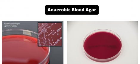 Anaerobic Blood Agar Composition, Principle, Preparation, Results, Uses