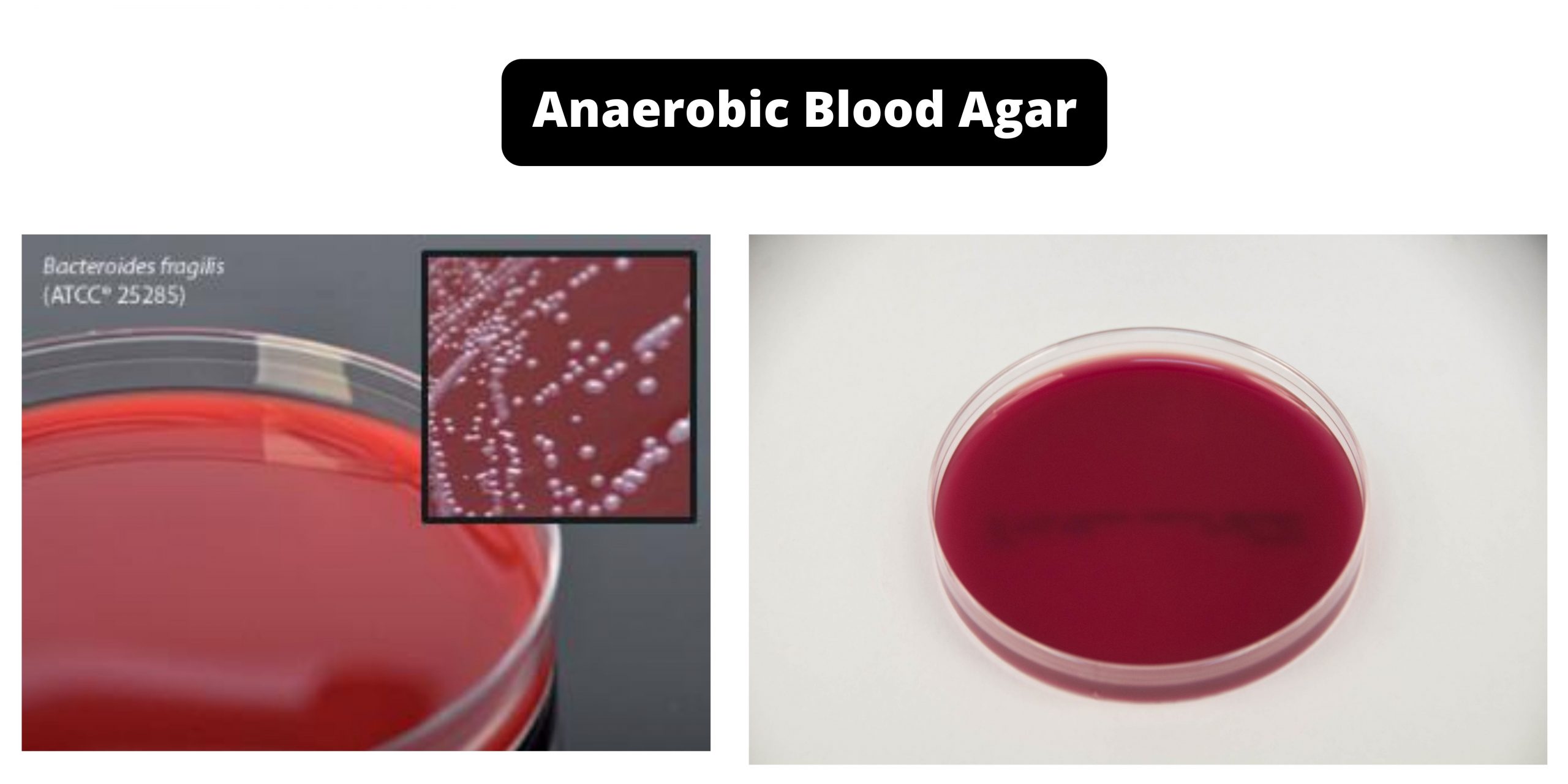 Anaerobic Blood Agar Composition, Principle, Preparation, Results, Uses