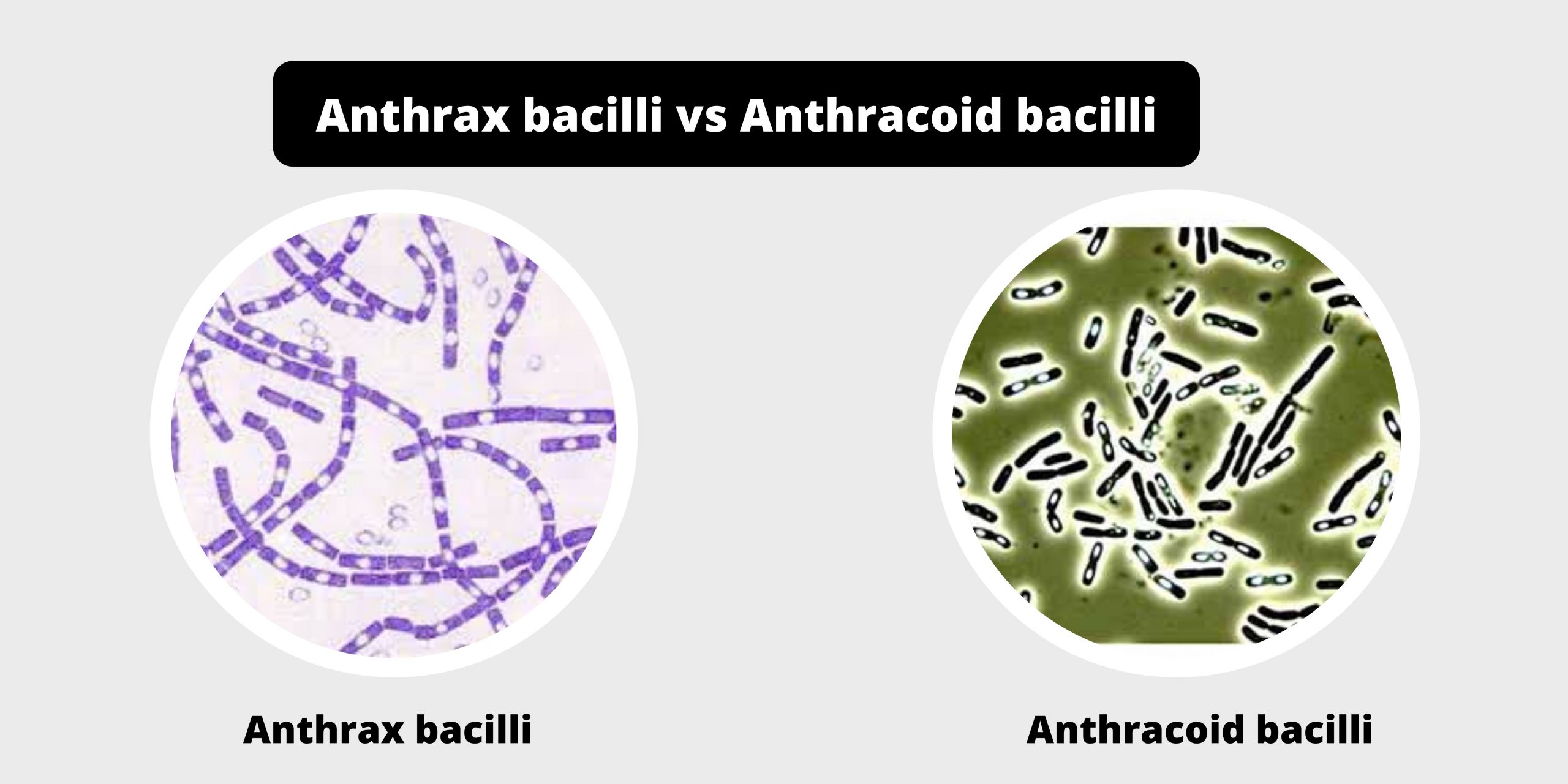 Differences between Anthrax bacilli and Anthracoid bacilli