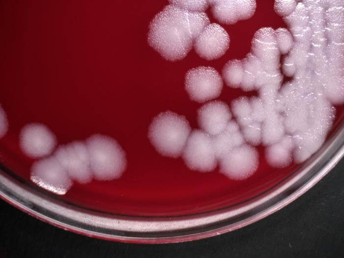 Bacillus anthracis on Blood Agar
