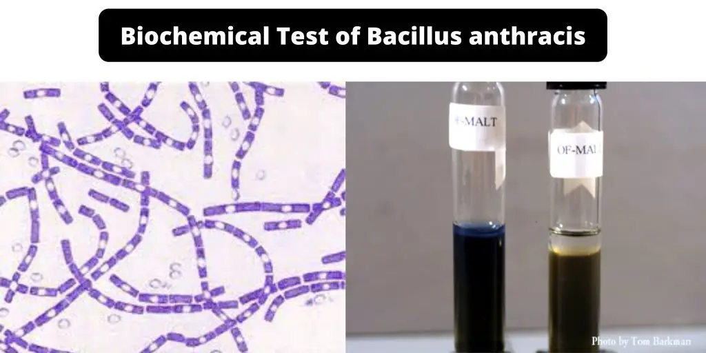 Biochemical Test of Bacillus anthracis