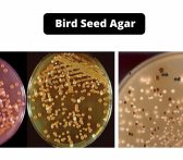 Bird Seed Agar Composition, Principle, Preparation, Results, Uses, Limitations
