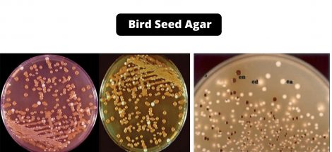 Bird Seed Agar Composition, Principle, Preparation, Results, Uses, Limitations