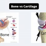 Difference Between Bone and Cartilage - Bone vs Cartilage
