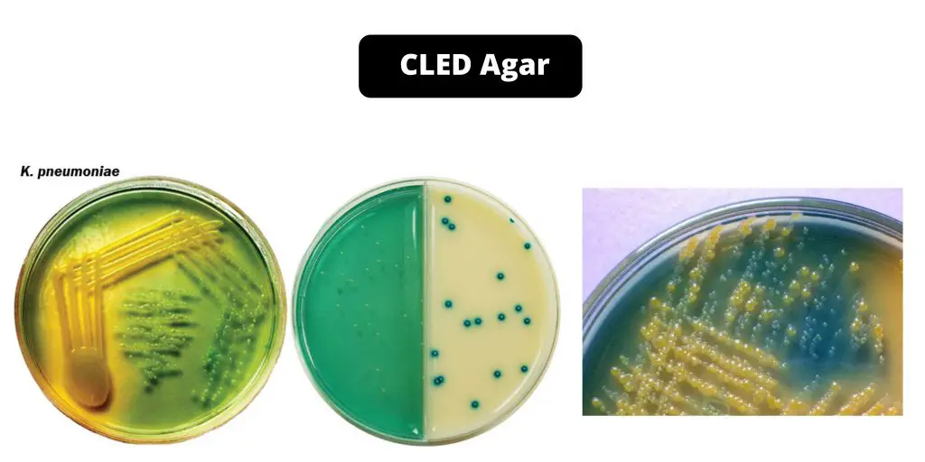CLED Agar Composition, Principle, Preparation, Results, Uses