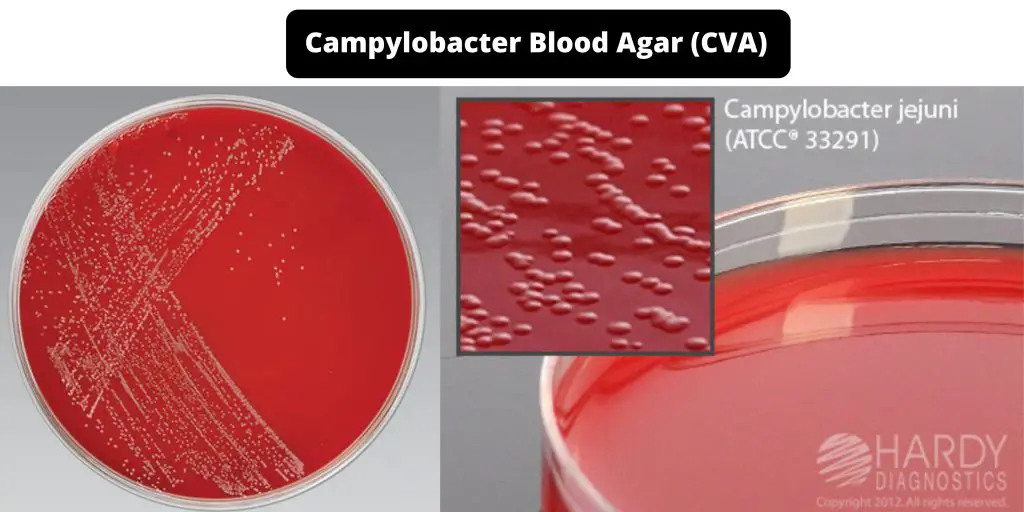 Campylobacter Blood Agar (CVA) Composition, Principle, Preparation, Results, Uses