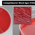 Campylobacter Blood Agar (CVA) Composition, Principle, Preparation, Results, Uses