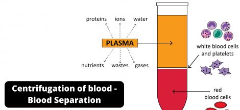 Centrifugation of blood - Blood Separation