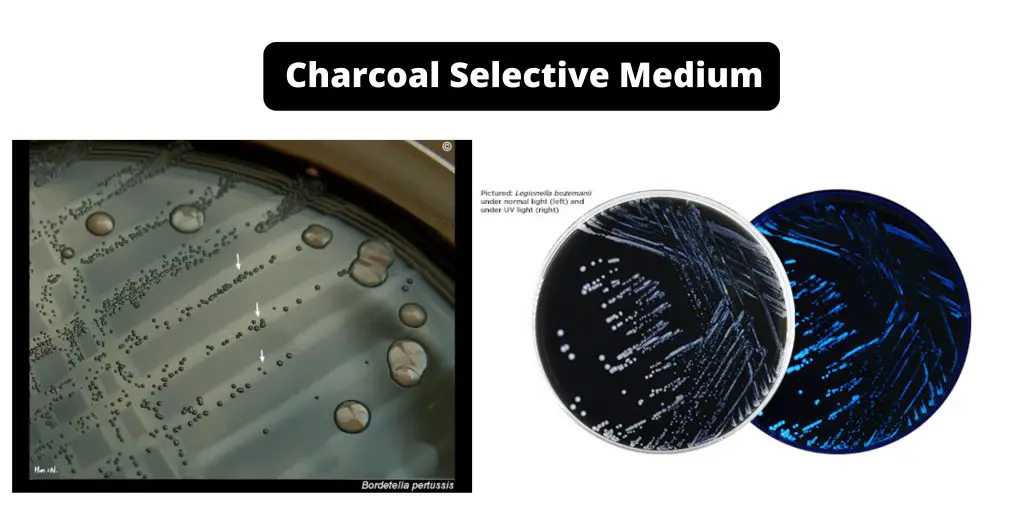 Charcoal Selective Medium Composition, Principle, Preparation, Results, Uses
