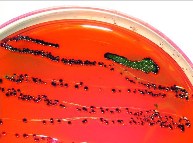E. coli on EMB agar