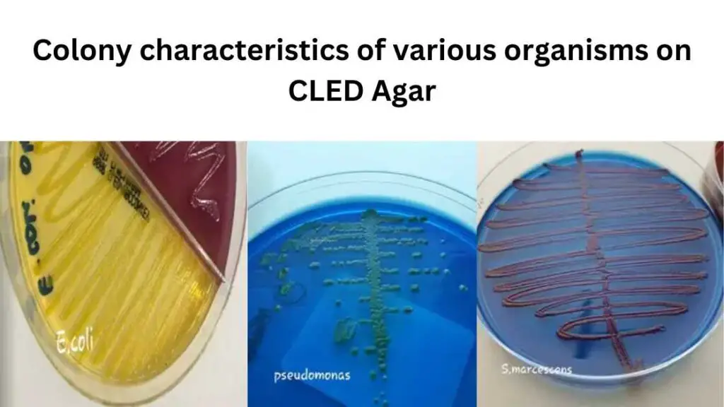 Colony characteristics of various organisms on CLED Agar