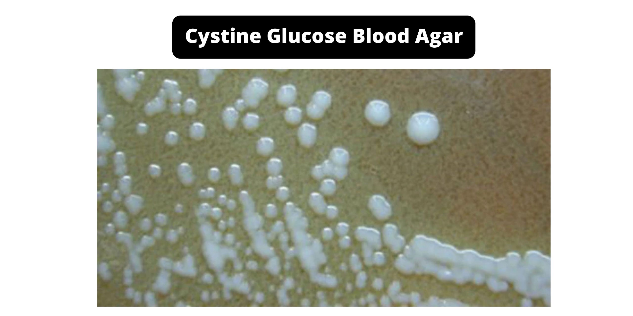 Cystine Glucose Blood Agar Composition, Principle, Preparation, Results, Uses