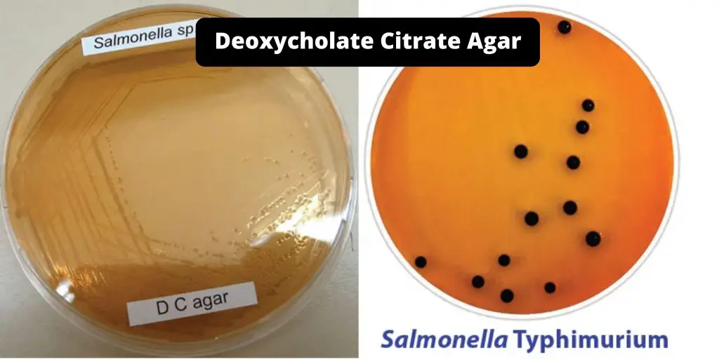 Deoxycholate Citrate Agar (DCA) Composition, Principle, Preparation, Results, Uses