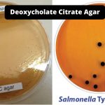 Deoxycholate Citrate Agar (DCA) Composition, Principle, Preparation, Results, Uses
