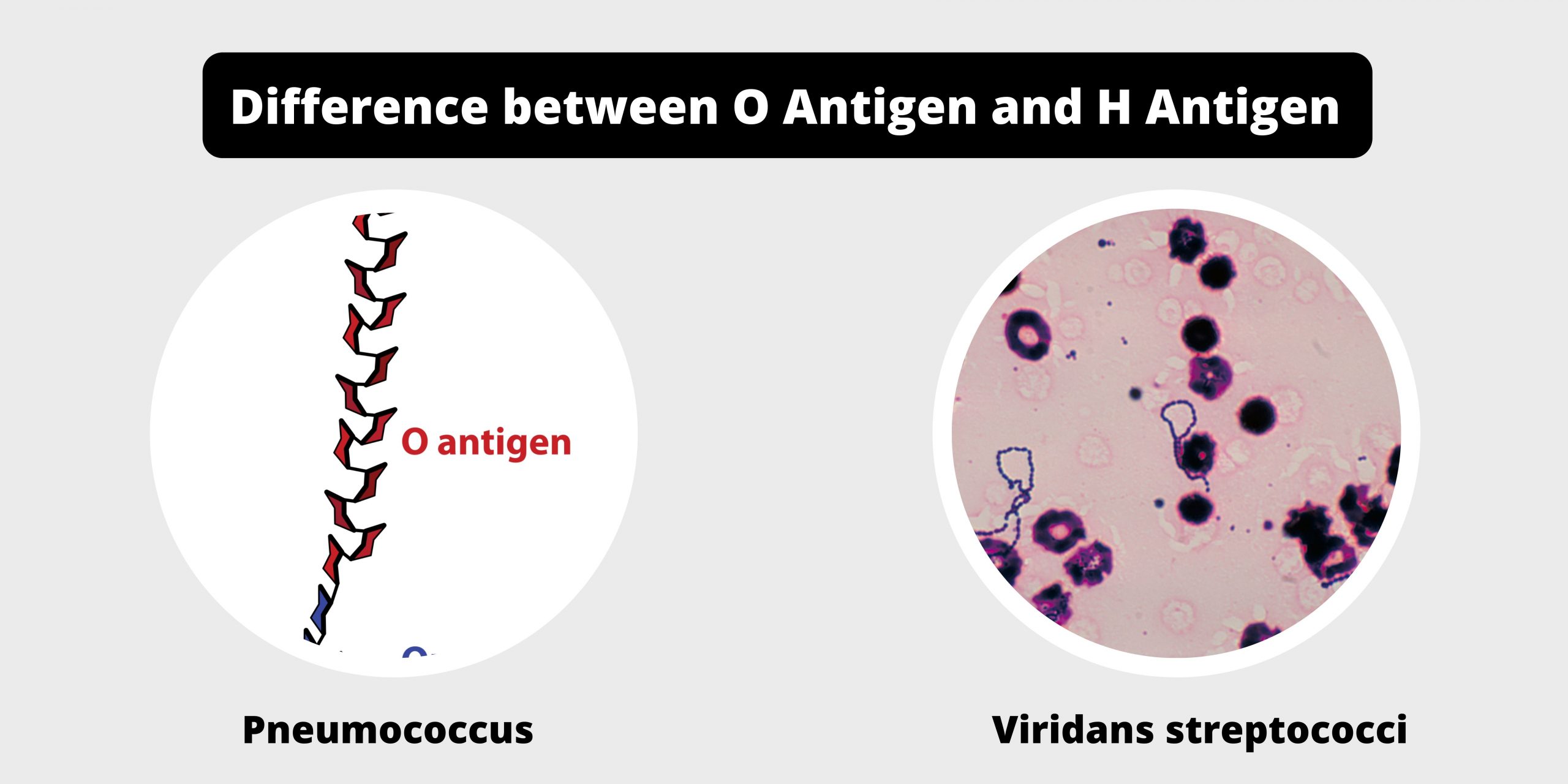 Difference between O antigen and H antigen - O vs H antigen