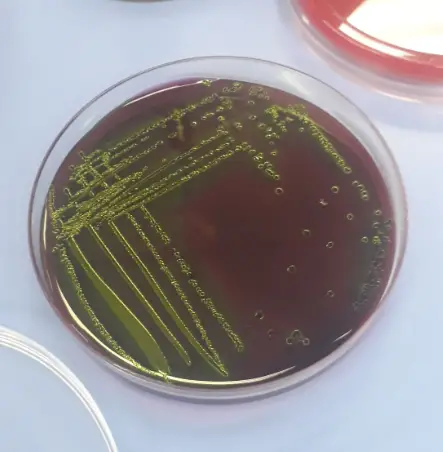Metallic green sheen of E. coli on EMB agar