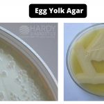 Egg Yolk Agar Composition, Principle, Preparation, Results, Uses