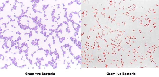 Gram Staining Results for Gram-positive and Gram-Negative Bacteria