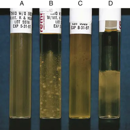 Growth characteristics of various bacteria in thioglycollate broth
