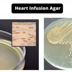 Heart Infusion Agar Composition, Principle, Preparation, Results, Uses