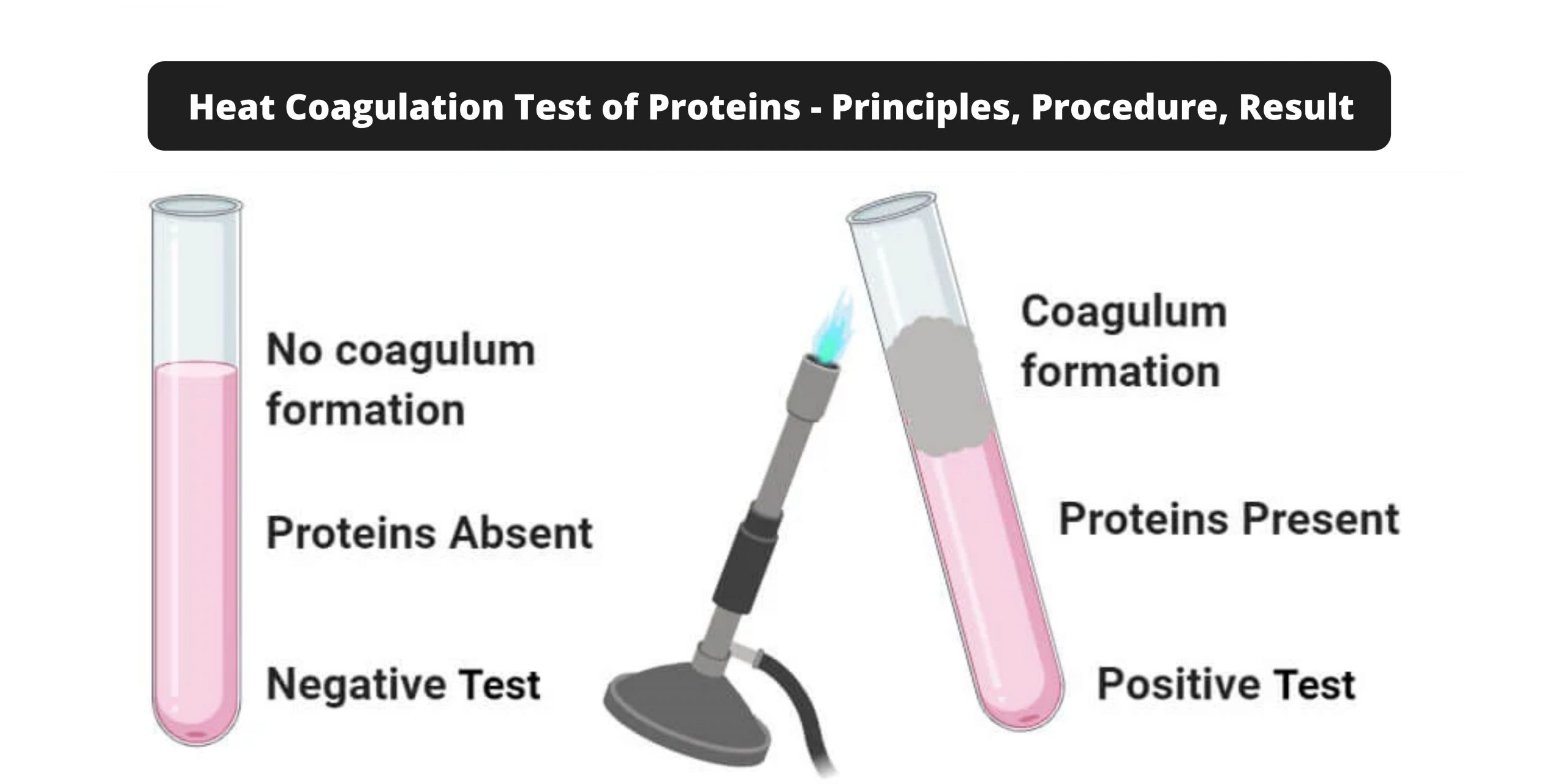Heat Coagulation Test of Proteins - Principles, Procedure, Result