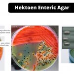 Hektoen Enteric Agar Composition, Principle, Preparation, Results, Uses
