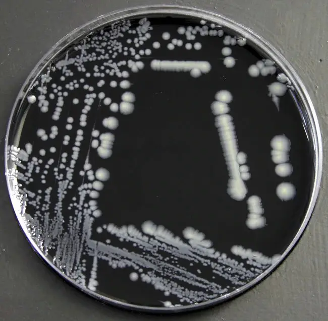 Legionella colonies in BCYE Agar