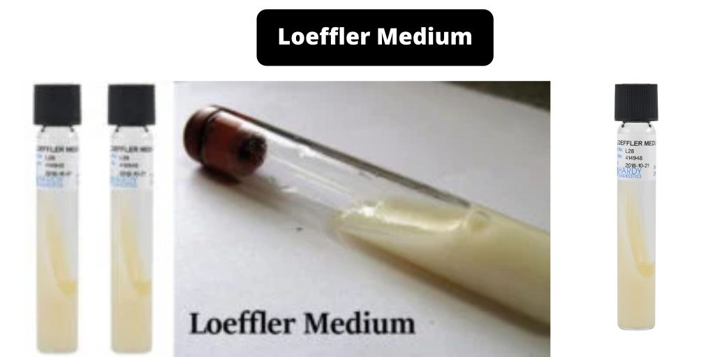 Loeffler Medium Composition, Principle, Preparation, Results, Uses